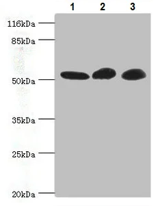 Western blot - Anti-GDI2 antibody (AB234986)