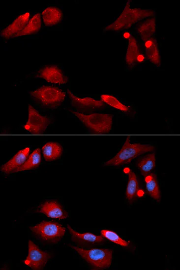 Immunocytochemistry/ Immunofluorescence - Anti-GDNF Receptor alpha 1/GFRA1 antibody (AB186855)
