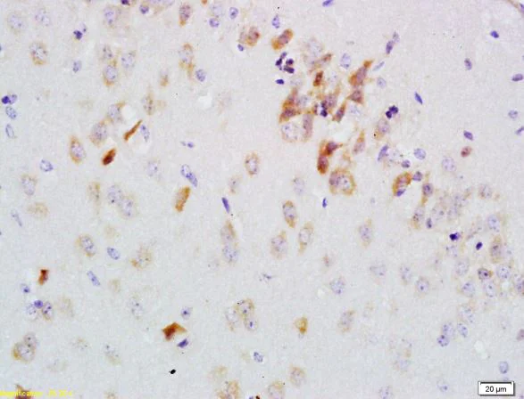 Immunohistochemistry (Formalin/PFA-fixed paraffin-embedded sections) - Anti-GDNF Receptor alpha 2/GFRA2 antibody (AB216417)