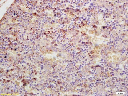 Immunohistochemistry (Formalin/PFA-fixed paraffin-embedded sections) - Anti-GDPD3 antibody (AB214375)