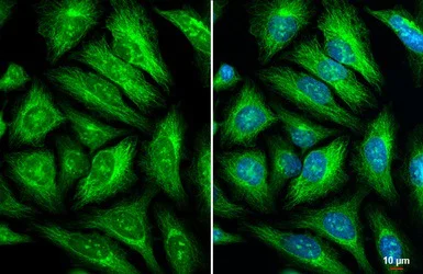 Immunocytochemistry/ Immunofluorescence - Anti-GEF H1 antibody (AB155785)