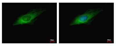 Immunocytochemistry/ Immunofluorescence - Anti-GEF H1 antibody (ab155785), expandable thumbnail