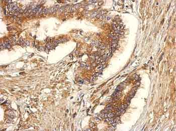 Immunohistochemistry (Formalin/PFA-fixed paraffin-embedded sections) - Anti-GEF H1 antibody (AB155785), expandable thumbnail