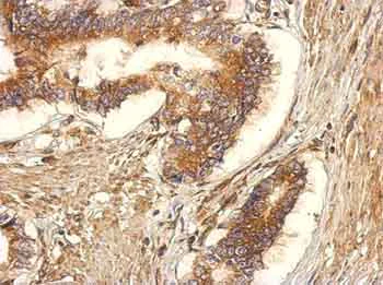Immunohistochemistry (Formalin/PFA-fixed paraffin-embedded sections) - Anti-GEF H1 antibody (AB155785)