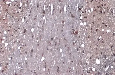 Immunohistochemistry (Formalin/PFA-fixed paraffin-embedded sections) - Anti-GEF H1 antibody (AB155785)