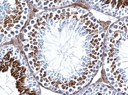Immunohistochemistry (Formalin/PFA-fixed paraffin-embedded sections) - Anti-GEF H1 antibody (AB155785), expandable thumbnail