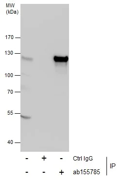 Immunoprecipitation - Anti-GEF H1 antibody (AB155785)