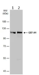 Western blot - Anti-GEF H1 antibody (AB155785)