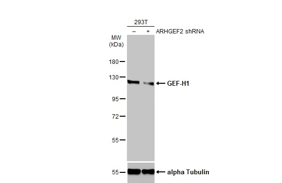 Western blot - Anti-GEF H1 antibody (AB155785)