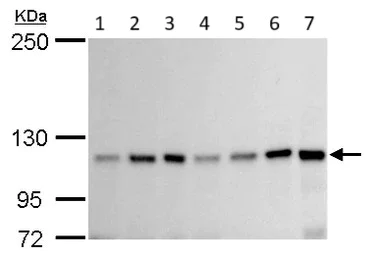 Western blot - Anti-GEF H1 antibody (AB155785)
