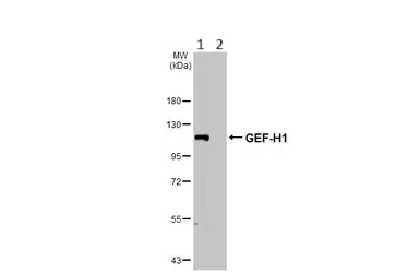 Western blot - Anti-GEF H1 antibody (AB155785)