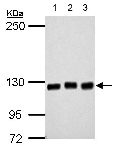 Western blot - Anti-GEF H1 antibody (AB155785), expandable thumbnail