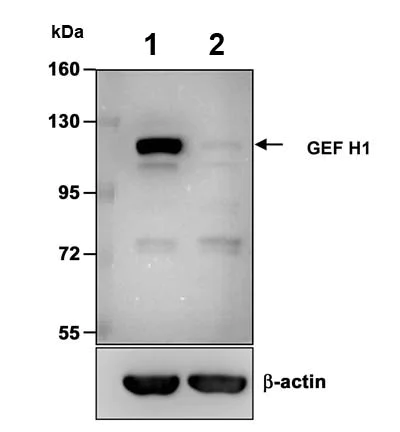 Western blot - Anti-GEF H1 antibody (AB155785)