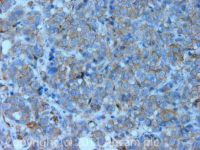 Immunohistochemistry (Formalin/PFA-fixed paraffin-embedded sections) - Anti-GEF H1 antibody [B4/7] (AB90783)