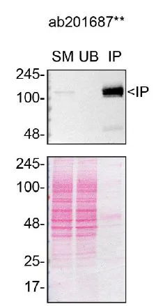 Immunoprecipitation - Anti-GEF H1 antibody [EPR17963] - BSA and Azide free (AB251352)