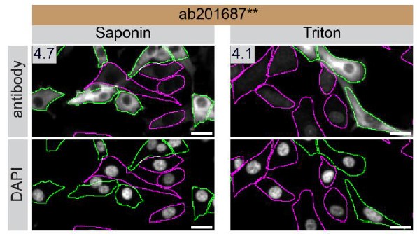 Immunocytochemistry/ Immunofluorescence - Anti-GEF H1 antibody [EPR17963] - C-terminal (AB201687)