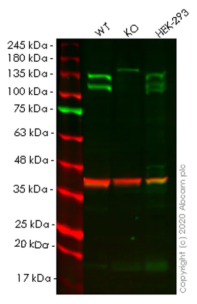 Western blot - Anti-GEF H1 antibody [EPR17963] - C-terminal (AB201687)