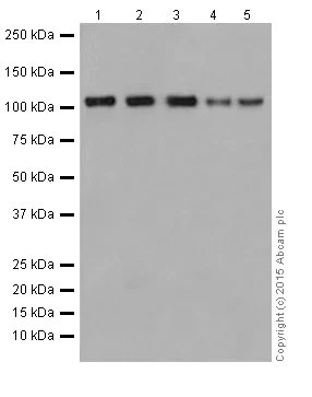Western blot - Anti-GEF H1 antibody [EPR17963] - C-terminal (AB201687)