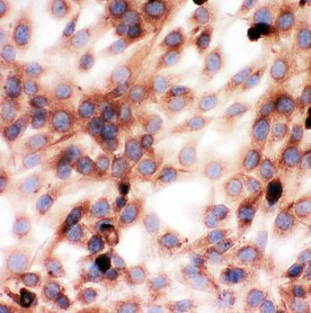 Immunocytochemistry - Anti-Gelsolin antibody - C-terminal (AB191134)