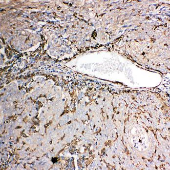 Immunohistochemistry (Formalin/PFA-fixed paraffin-embedded sections) - Anti-Gelsolin antibody - C-terminal (AB191134)