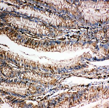 Immunohistochemistry (Formalin/PFA-fixed paraffin-embedded sections) - Anti-Gelsolin antibody - C-terminal (AB191134)