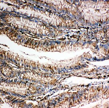 Immunohistochemistry (Formalin/PFA-fixed paraffin-embedded sections) - Anti-Gelsolin antibody - C-terminal (AB191134)