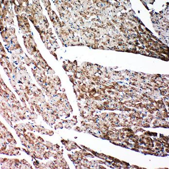 Immunohistochemistry (Formalin/PFA-fixed paraffin-embedded sections) - Anti-Gelsolin antibody - C-terminal (AB191134)