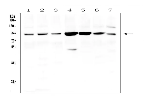 Western blot - Anti-Gelsolin antibody - C-terminal (AB191134)