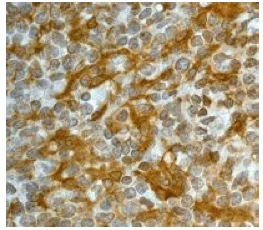 Immunohistochemistry (Formalin/PFA-fixed paraffin-embedded sections) - Anti-Gelsolin antibody [EP1940Y] - BSA and Azide free (AB284809)