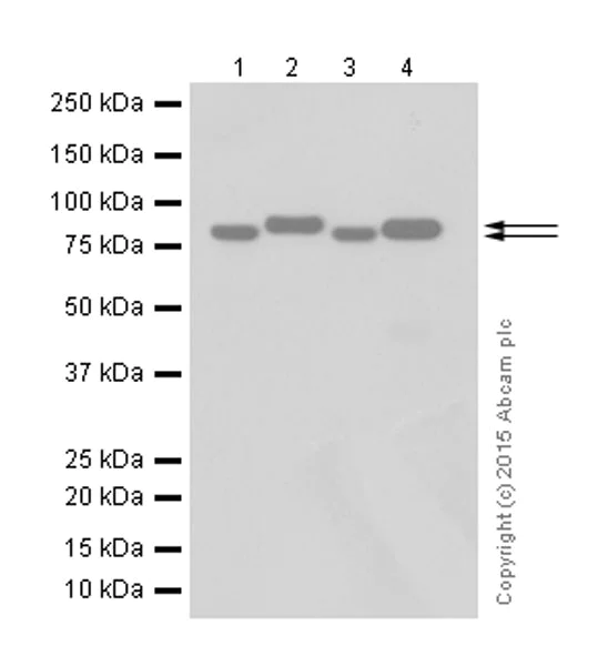 Western blot - Anti-Gelsolin antibody [EPR1942] (AB109014)