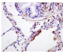Immunohistochemistry (Formalin/PFA-fixed paraffin-embedded sections) - Anti-Gelsolin antibody [EPR1942] - BSA and Azide free (AB236029)