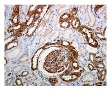 Immunohistochemistry (Formalin/PFA-fixed paraffin-embedded sections) - Anti-Gelsolin antibody [EPR1942] - BSA and Azide free (AB236029)