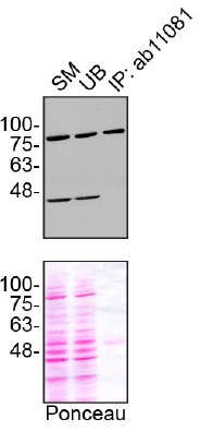 Anti-Gelsolin antibody [GS-2C4]