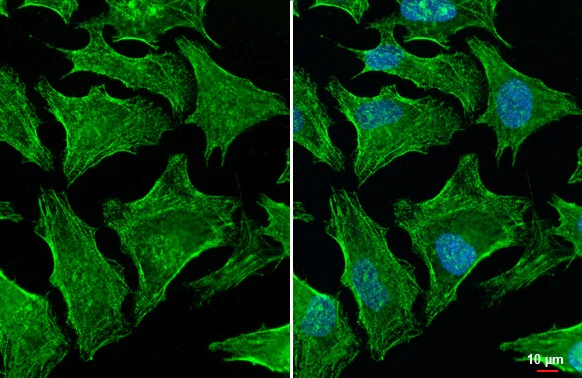 Immunocytochemistry/ Immunofluorescence - Anti-Gelsolin antibody [HL1930] (AB308207)