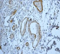 Immunohistochemistry (Formalin/PFA-fixed paraffin-embedded sections) - Anti-Gelsolin plasma antibody [EPR1941Y] - BSA and Azide free (AB247406), expandable thumbnail