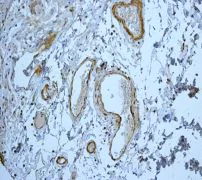 Immunohistochemistry (Formalin/PFA-fixed paraffin-embedded sections) - Anti-Gelsolin plasma antibody [EPR1941Y] - BSA and Azide free (AB247406)