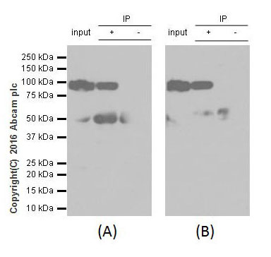 Immunoprecipitation - Anti-Gelsolin plasma antibody [EPR1941Y] - BSA and Azide free (AB247406), expandable thumbnail