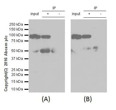 Immunoprecipitation - Anti-Gelsolin plasma antibody [EPR1941Y] - BSA and Azide free (AB247406)