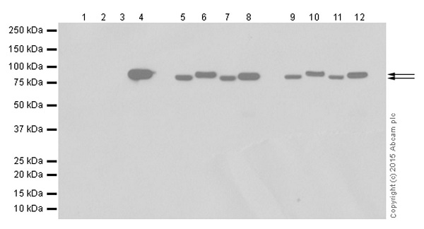 Western blot - Anti-Gelsolin plasma antibody [EPR1941Y] - BSA and Azide free (AB247406), expandable thumbnail
