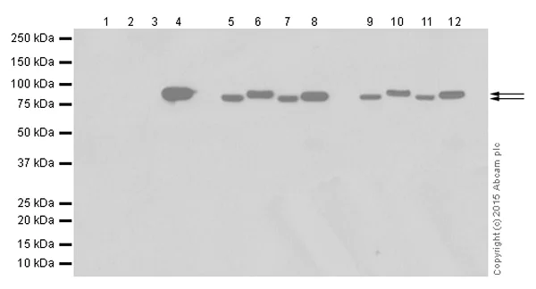 Western blot - Anti-Gelsolin plasma antibody [EPR1941Y] - BSA and Azide free (AB247406)