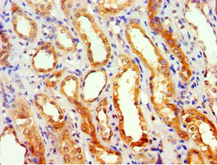 Immunohistochemistry (Formalin/PFA-fixed paraffin-embedded sections) - Anti-GEM antibody (AB238606)