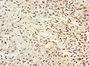 Immunohistochemistry (Formalin/PFA-fixed paraffin-embedded sections) - Anti-GEM antibody (AB238606)