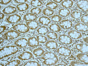 Immunohistochemistry (Formalin/PFA-fixed paraffin-embedded sections) - Anti-Gemin 3 antibody [EPR11283] - BSA and Azide free (AB249394)