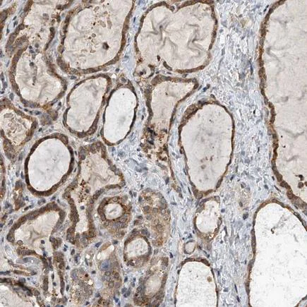 Immunohistochemistry (Formalin/PFA-fixed paraffin-embedded sections) - Anti-Gemin 8 antibody (AB224758)