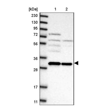 Western blot - Anti-Gemin 8 antibody (AB224758)