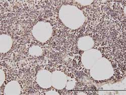 Immunohistochemistry (Formalin/PFA-fixed paraffin-embedded sections) - Anti-Geminin antibody [1A8] (AB104306), expandable thumbnail