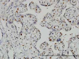 Immunohistochemistry (Formalin/PFA-fixed paraffin-embedded sections) - Anti-Geminin antibody [1A8] (ab104306), expandable thumbnail