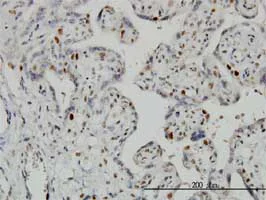 Immunohistochemistry (Formalin/PFA-fixed paraffin-embedded sections) - Anti-Geminin antibody [1A8] (AB104306)