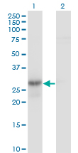 Western blot - Anti-Geminin antibody [1A8] (AB104306), expandable thumbnail