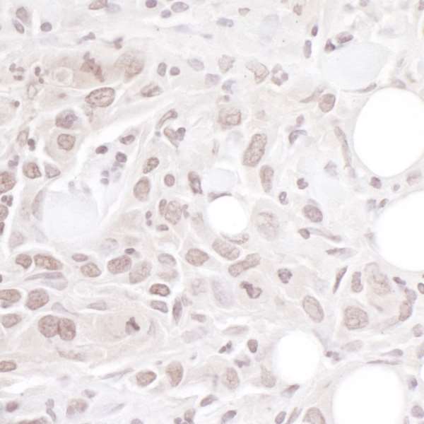 Immunohistochemistry (Formalin/PFA-fixed paraffin-embedded sections) - Anti-Geminin antibody (AB264157), expandable thumbnail